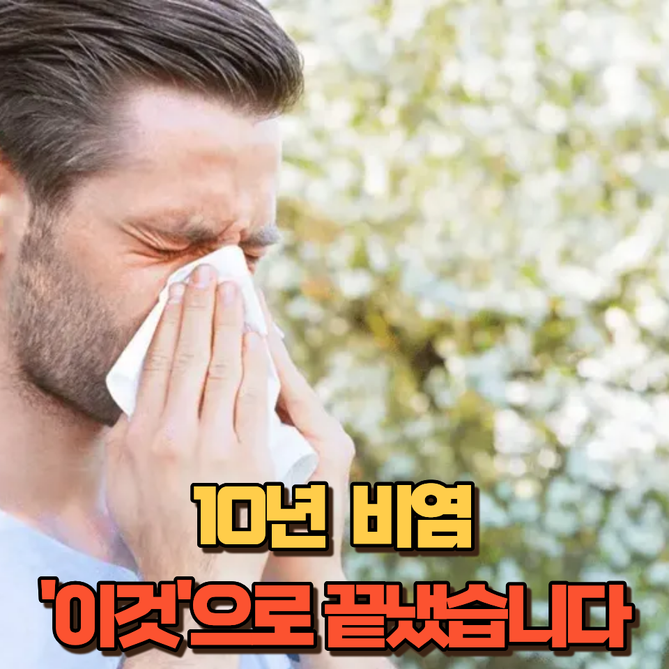 알레르기성 비염